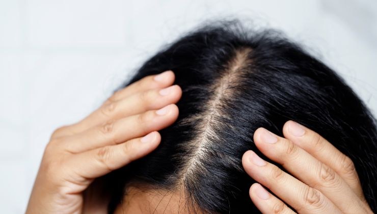 pelo cabello mujer salud capilar